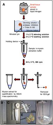 AQUA Mutant Protein Quantification of Endomyocardial Biopsy-Sized Samples From a Patient With Hypertrophic Cardiomyopathy